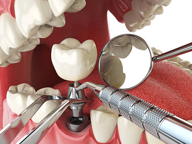 Best Emergency TMJ Treatment in Naval Academy, MD