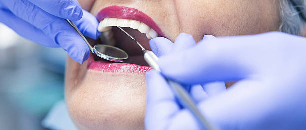Best Urgent Care for Lost Fillings or Crowns in Naval Academy, MD